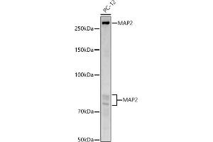 Western Blotting (WB) image for anti-Microtubule-Associated Protein 2 (MAP2) (AA 260-559) antibody (ABIN3016265)