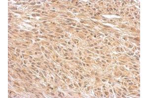 IHC-P Image O-GlcNAc transferase antibody [N1N2], N-term detects OGT protein at cytosol on U373 xenograft by immunohistochemical analysis. (OGT 抗体  (N-Term))