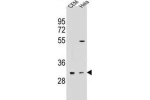 Western Blotting (WB) image for anti-Olfactory Receptor, Family 5, Subfamily L, Member 2 (OR5L2) antibody (ABIN2995999)