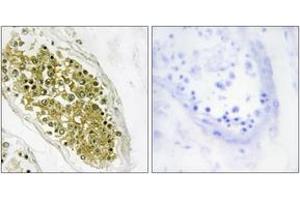 Immunohistochemistry analysis of paraffin-embedded human testis tissue, using HIPK4 Antibody. (HIPK4 抗体  (AA 511-560))