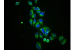 Immunofluorescence staining of Hela cells with ABIN7170075 at 1:100, counter-stained with DAPI. (SLC12A3 抗体  (AA 791-952))