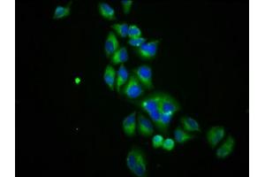 Immunofluorescence (IF) image for anti-Solute Carrier Family 12 (Sodium/Chloride Transporters), Member 3 (SLC12A3) (AA 791-952) antibody (ABIN7170075)