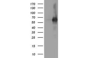 Western Blotting (WB) image for anti-phosphodiesterase 1B, Calmodulin-Dependent (PDE1B) antibody (ABIN1500073) (PDE1B 抗体)