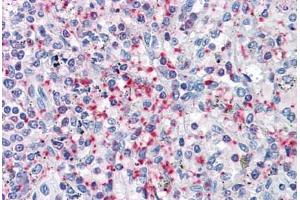 Human Spleen: Formalin-Fixed, Paraffin-Embedded (FFPE) (Pleckstrin 抗体  (AA 121-231))