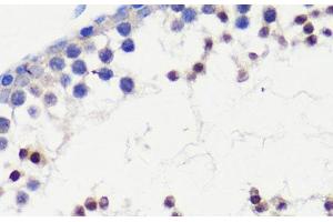 Immunohistochemistry of paraffin-embedded Mouse testis using HFM1 Polyclonal Antibody at dilution of 1:100 (40x lens). (HFM1 抗体)