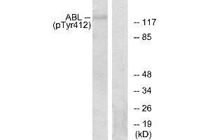 Immunohistochemistry analysis of paraffin-embedded human brain tissue using Abl (Phospho-Tyr393/412) antibody. (ABL1 抗体  (pTyr393, pTyr412))