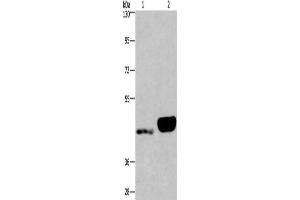 Gel: 6 % SDS-PAGE, Lysate: 40 μg, Lane 1-2: Human endometrial cancer tissue, Human placenta tissue, Primary antibody: ABIN7190562(ENPP4 Antibody) at dilution 1/200, Secondary antibody: Goat anti rabbit IgG at 1/8000 dilution, Exposure time: 40 seconds (ENPP4 抗体)