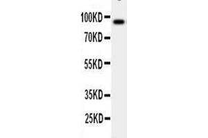 Anti-GCSF Receptor antibody, Western blotting WB: Human Placenta Tissue Lysate (CSF3R 抗体  (Middle Region))