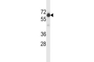 Western Blotting (WB) image for anti-Beclin 1, Autophagy Related (BECN1) (AA 100-123) antibody (ABIN3028504)