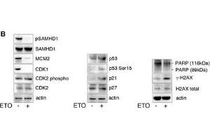ETO regulates SAMHD1 phosphorylation through the p53, p21 pathwayMDM were treated with increasing concentrations of ETO and CTH. (p53 抗体  (N-Term))