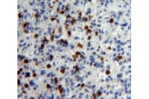 Used in DAB staining on fromalin fixed paraffin-embedded Spleen tissue (IFNA5 抗体  (AA 22-189))