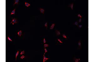 ABIN6268837 staining U-251 MG cells by IF/ICC. (Galectin 9 抗体  (Internal Region))