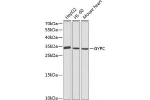 Western blot analysis of extracts of various cell lines using GYPC Polyclonal Antibody at dilution of 1:1000. (CD236/GYPC 抗体)