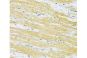 Immunohistochemistry of paraffin-embedded Rat heart using TYROBP Polyclonal Antibody at dilution of 1:100 (40x lens).