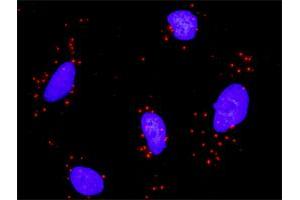 Proximity Ligation Analysis of protein-protein interactions between HDAC2 and PPARD. (HDAC2 抗体  (AA 1-582))