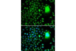 Immunofluorescence (IF) image for anti-TAF5 RNA Polymerase II, TATA Box Binding Protein (TBP)-Associated Factor, 100kDa (TAF5) (AA 656-800) antibody (ABIN6148826)
