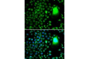 Immunofluorescence analysis of A-549 cells using TAF5 antibody. (TAF5 抗体  (AA 656-800))
