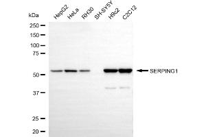 Western blotting analysis using SERPING1 antibody (ABIN7800320).