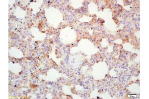 Formalin-fixed and paraffin embedded mouse lung labeled with Rabbit Anti Integrin alpha 4/CD49d/Integrin ? (ITGA4 抗体  (AA 551-650))