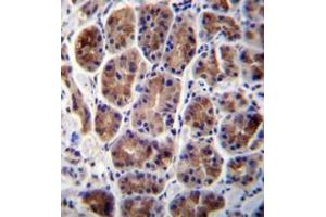 Immunohistochemistry analysis in formalin fixed and paraffin embedded human stomach tissue reacted with MAN2A2 Antibody (Center) followed which was peroxidase conjugated to the secondary antibody and followed by DAB staining. (MAN2A2 抗体  (Middle Region))