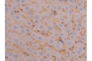 IHC-P analysis of Rat Liver Tissue, with DAB staining. (Fibrinogen beta Chain 抗体  (AA 33-479))