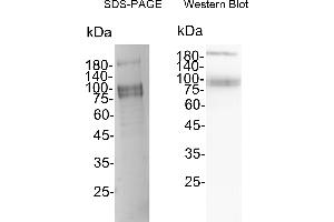 Western Blotting (WB) image for SARS-CoV-2 Spike (SARS-CoV-2 S) (B.1.351 - beta), (Trimer) protein (His tag) (ABIN7884576)