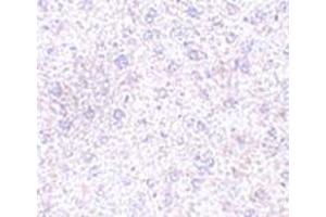 Immunohistochemistry of TEM7 in mouse liver tissue with this product at 2. (PLXDC1 抗体  (C-Term))