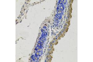 Immunohistochemistry of paraffin-embedded mouse lung using GAS6 antibody. (GAS6 抗体)