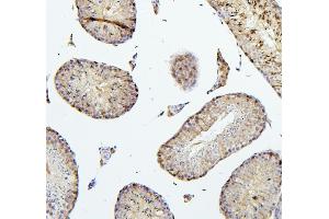 IHC analysis of TEK using anti-TEK antibody (ABIN7600762). (TEK 抗体  (AA 23-616))