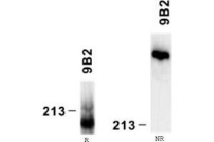 Western Blotting (WB) image for anti-Laminin, alpha 4 (LAMa4) antibody (ABIN781771) (LAMa4 抗体)