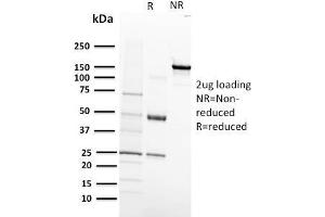 SDS-PAGE Analysis Purified VEGF-R1 Mouse Monoclonal Antibody (FLT1/658). (FLT1 抗体)