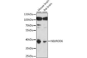 Western blot analysis of extracts of various cell lines, using NEUROD6 antibody (ABIN7268868) at 1:1000 dilution. (NEUROD6 抗体  (AA 188-337))