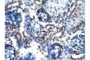 Image no. 1 for anti-BCL2-Associated X Protein (BAX) (N-Term) antibody (ABIN202051)