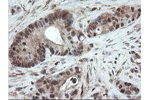 Image no. 2 for anti-Pyridoxamine 5'-Phosphate Oxidase (PNPO) antibody (ABIN1500318) (PNPO 抗体)