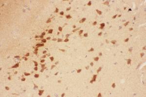Anti-BDNF Picoband antibody,  IHC(P): Rat Brain Tissue (BDNF 抗体  (AA 129-247))