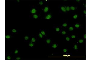 Immunofluorescence (IF) image for anti-Topoisomerase I Binding, arginine/serine-Rich, E3 Ubiquitin Protein Ligase (TOPORS) (AA 98-205) antibody (ABIN564418)