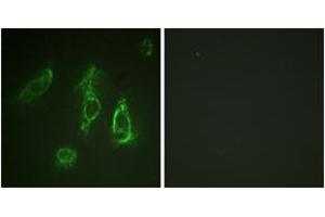 Immunofluorescence analysis of HeLa cells, using Epo-R (Ab-368) Antibody. (EPOR 抗体  (AA 341-390))