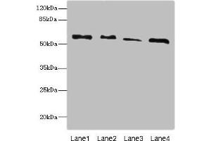 Western blot All lanes: RTKN antibody at 4. (Rhotekin 抗体  (AA 304-563))