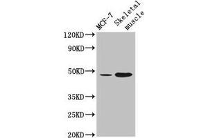 Western Blot Positive WB detected in: MCF-7 whole cell lysate, Mouse skeletal muscle tissue All lanes: ARRDC3 antibody at 4 μg/mL Secondary Goat polyclonal to rabbit IgG at 1/50000 dilution Predicted band size: 47 kDa Observed band size: 47 kDa (ARRDC3 抗体  (AA 1-270))