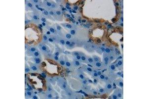 Immunohistochemical analysis of HSD3B7 staining in human kidney formalin fixed paraffin embedded tissue section. (HSD3B7 抗体)