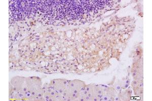 Immunohistochemistry (IHC) image for anti-Eukaryotic Translation Initiation Factor 4E Binding Protein 1 (EIF4EBP1) (pThr37), (pThr46) antibody (ABIN682978)