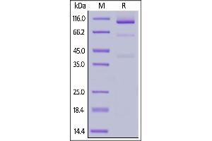SDS-PAGE (SDS) image for Glypican 3 (GPC3) (AA 25-559) protein (Fc Tag) (ABIN6938868)