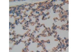 Immunohistochemistry (IHC) image for anti-Integrin, alpha X (Complement Component 3 Receptor 4 Subunit) (ITGAX) (AA 907-1115) antibody (ABIN7443875)