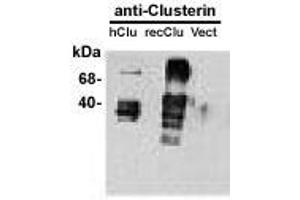 Image no. 1 for anti-Clusterin (CLU) antibody (ABIN187541) (Clusterin 抗体)
