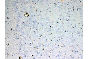 IHC analysis of ADA using anti-ADA antibody . (ADA 抗体  (AA 2-241))