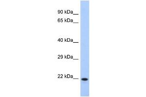 Western Blotting (WB) image for anti-Coiled-Coil Domain Containing 27 (CCDC27) (N-Term) antibody (ABIN2785189) (CCDC27 抗体  (N-Term))