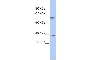 RD3 antibody used at 1 ug/ml to detect target protein. (RD3 抗体  (N-Term))