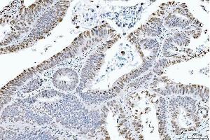 IHC analysis of CTBP2 using anti-CTBP2 antibody (ABIN7601325). (CTBP2 抗体  (AA 321-445))