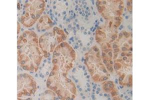 Used in DAB staining on fromalin fixed paraffin- embedded kidney tissue (HEXB 抗体  (AA 100-216))