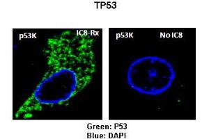 Sample Type: Rat thyrocytes-FRTL-5  Primary Antibody Dilution: 1:100 Secondary Antibody: Anti-rabbit-FITC  Secondary Antibody Dilution: 1:000 Color/Signal Descriptions: Green: TP53RKBlue: DAPI  Gene Name: TP53RK Submitted by: Syed A Morshed, Mount Sinai School of Medicine and James J Peters VA Medical Center (TP53RK 抗体  (N-Term))